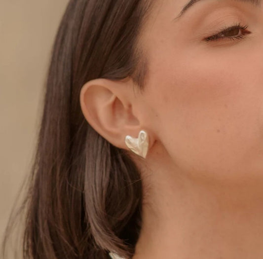 Aretes Topos Amorino